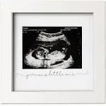 Baby Sonogram Picture Frame (ALPINE White)