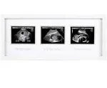 Pearhead Triple Sonogram Pregnancy Keepsake Trimester Sonogram Frame