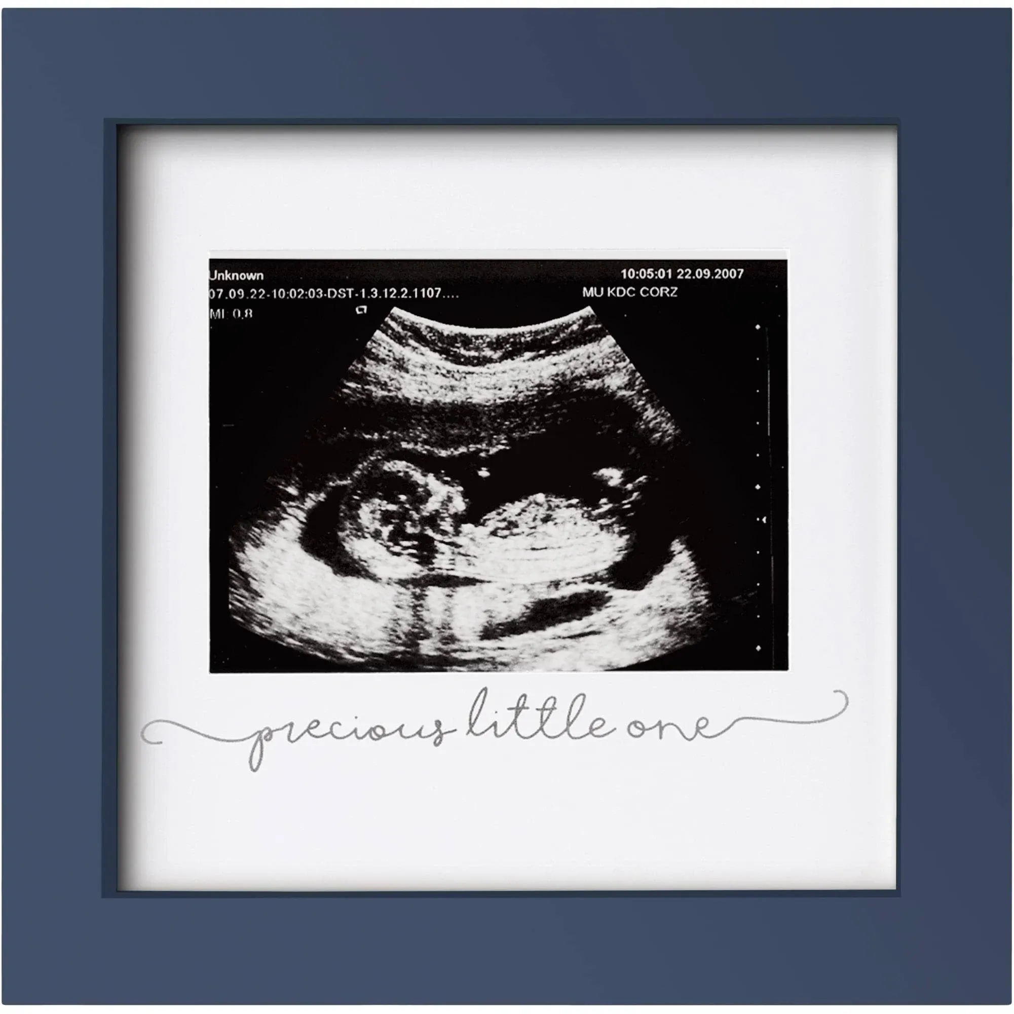 Baby Sonogram Picture Frame - Ultrasound Frames For New Parents