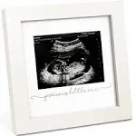 KeaBabies Solo Baby Sonogram Picture Frame