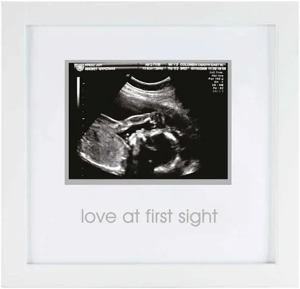 Pearhead Love at First Sight Sonogram Picture Frame, Gender Neutral Ultrasound Keepsake, Ideal Pregnancy Gift, Baby Shower and Nursery Decor, 4”x3” Photo Insert, White