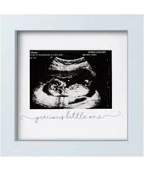 Baby Sonogram Picture Frame - Modern Ultrasound Frame for Mom to Be - Pregnancy 