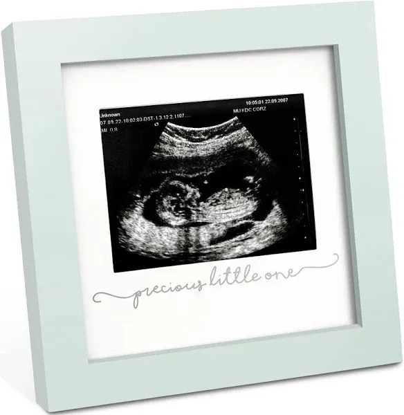 KeaBabies Baby Sonogram Picture Frame - Modern Ultrasound Frame for Mom to Be, Pregnancy Announcement Sonogram Photo Frames, Gender Reveal for Expecting Parents, First Time Dad Gifts (Sage)