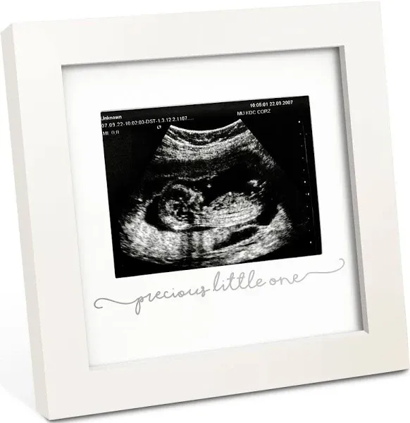 KeaBabies Solo Baby Sonogram Frame