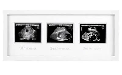 Pearhead Sonogram Progression Frame - Trimester by Trimester Pregnancy Milestone Keepsake, Gender-Neutral Nursery Decor, Displays 1st, 2nd & 3rd Trimester Ultrasound Photos, White