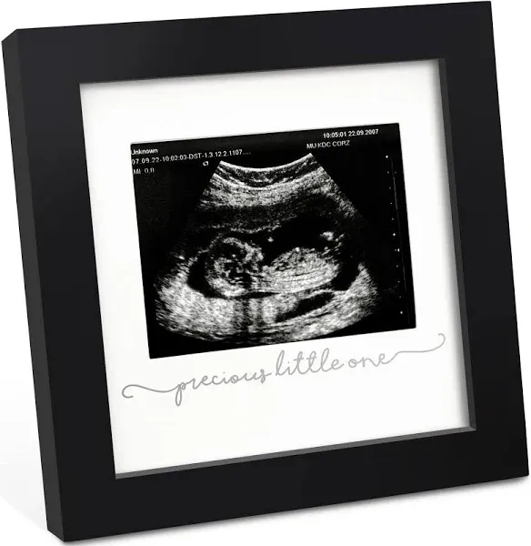 KeaBabies Solo Baby Sonogram Picture Frame: Alpine White