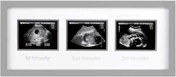 Pearhead Trimester Sonogram Frame