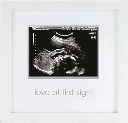 Pearhead Love at First Sight Sonogram Frame