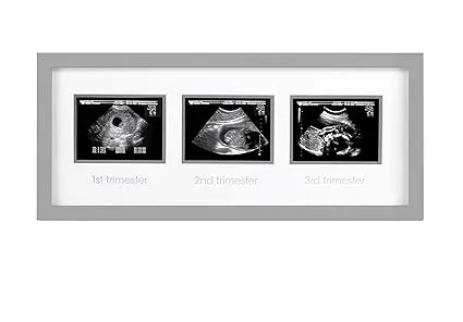 Pearhead Triple Sonogram Picture Frame, Pregnancy Keepsake Photo Frame, Gender-Neutral Baby Nursery Décor, Baby Accessory for New and Expecting Parents, Gray