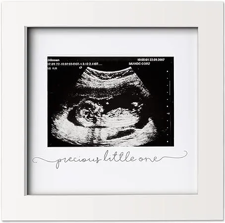 KeaBabies Solo Baby Sonogram Frame