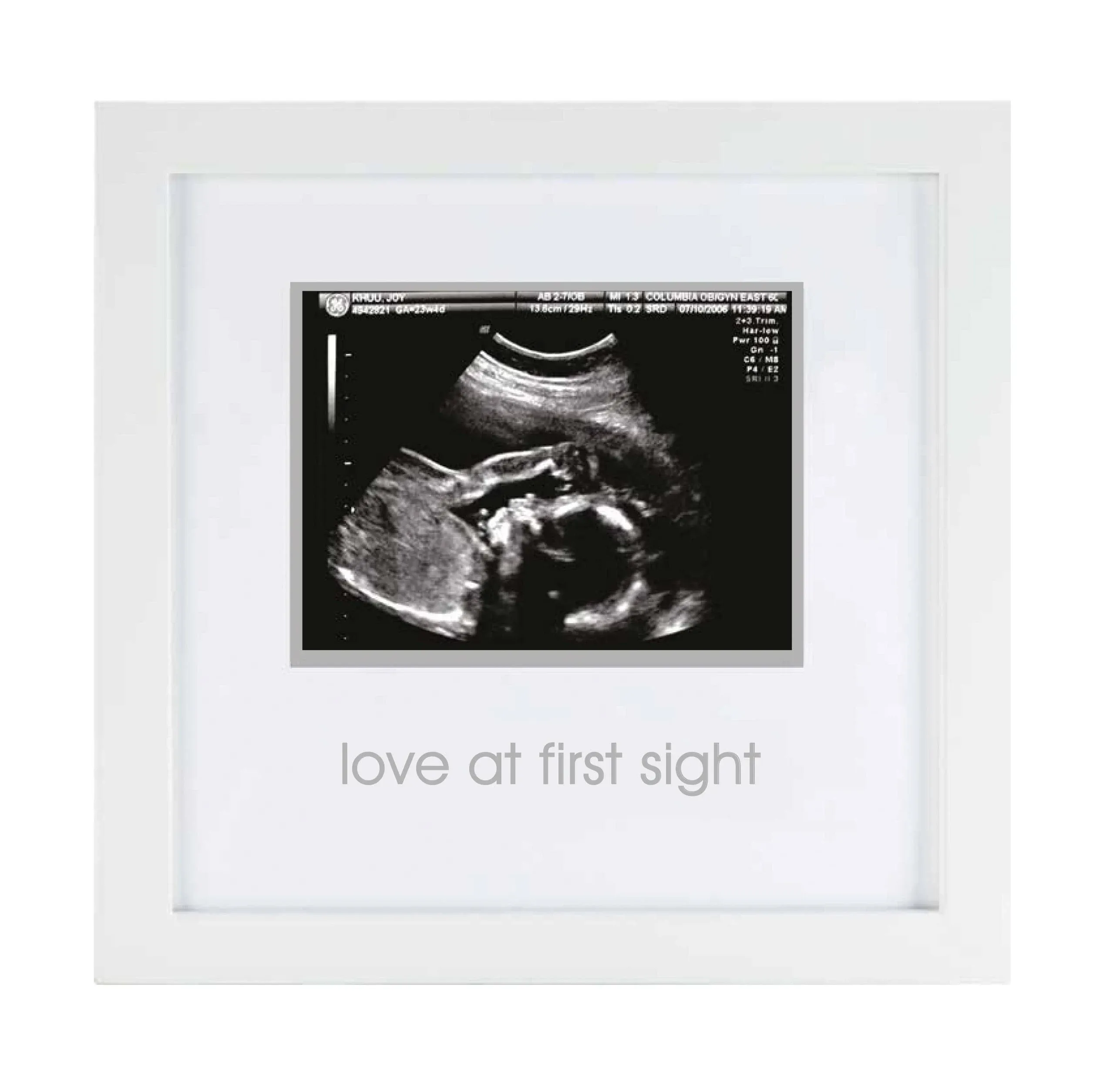 Baby Sonogram Picture Frame NWT