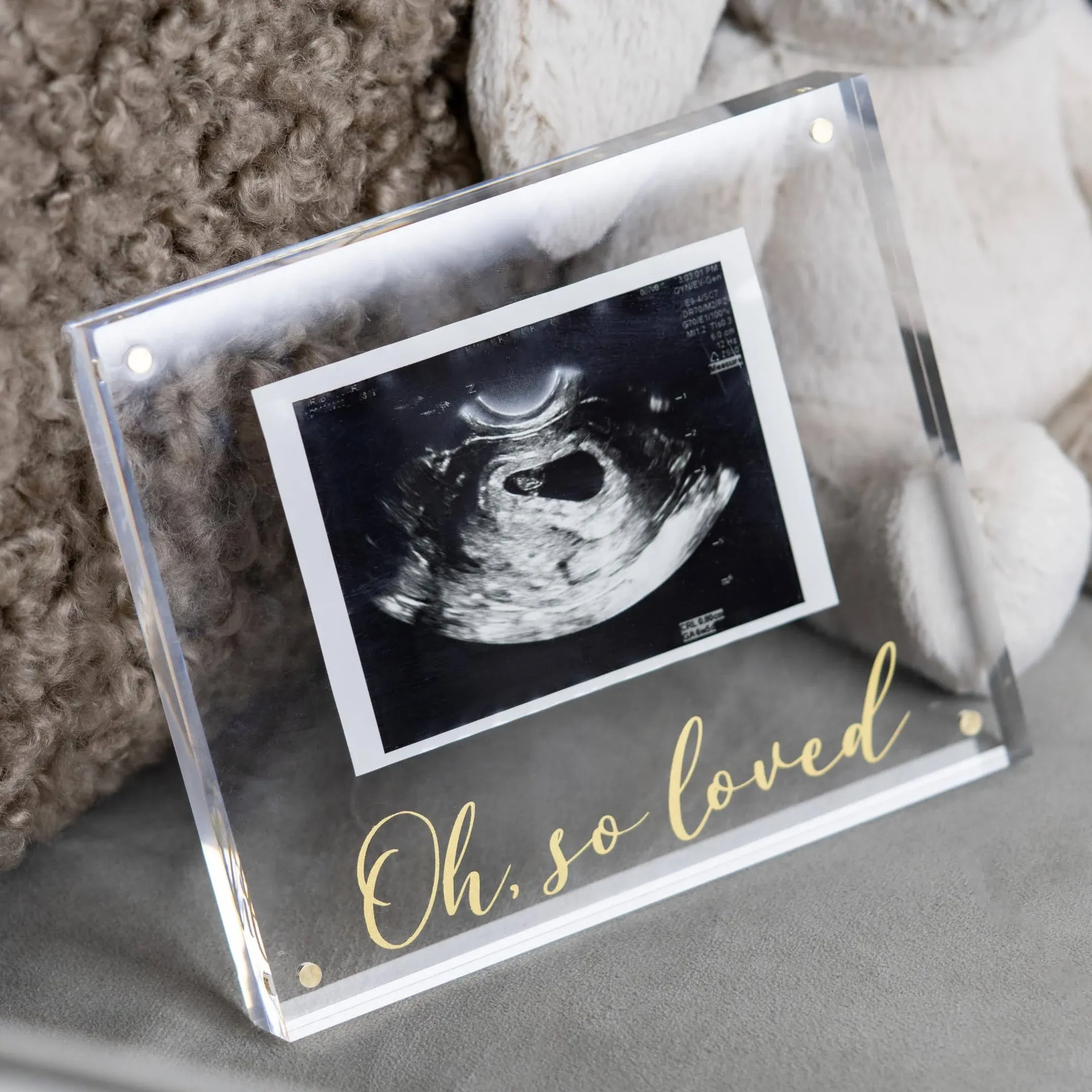 High-End Ultrasound Picture Frames - Acrylic & Gold Newborn Photo Sonogram Picture Frame - Grandparents Baby Announcement Ultrasound Frame