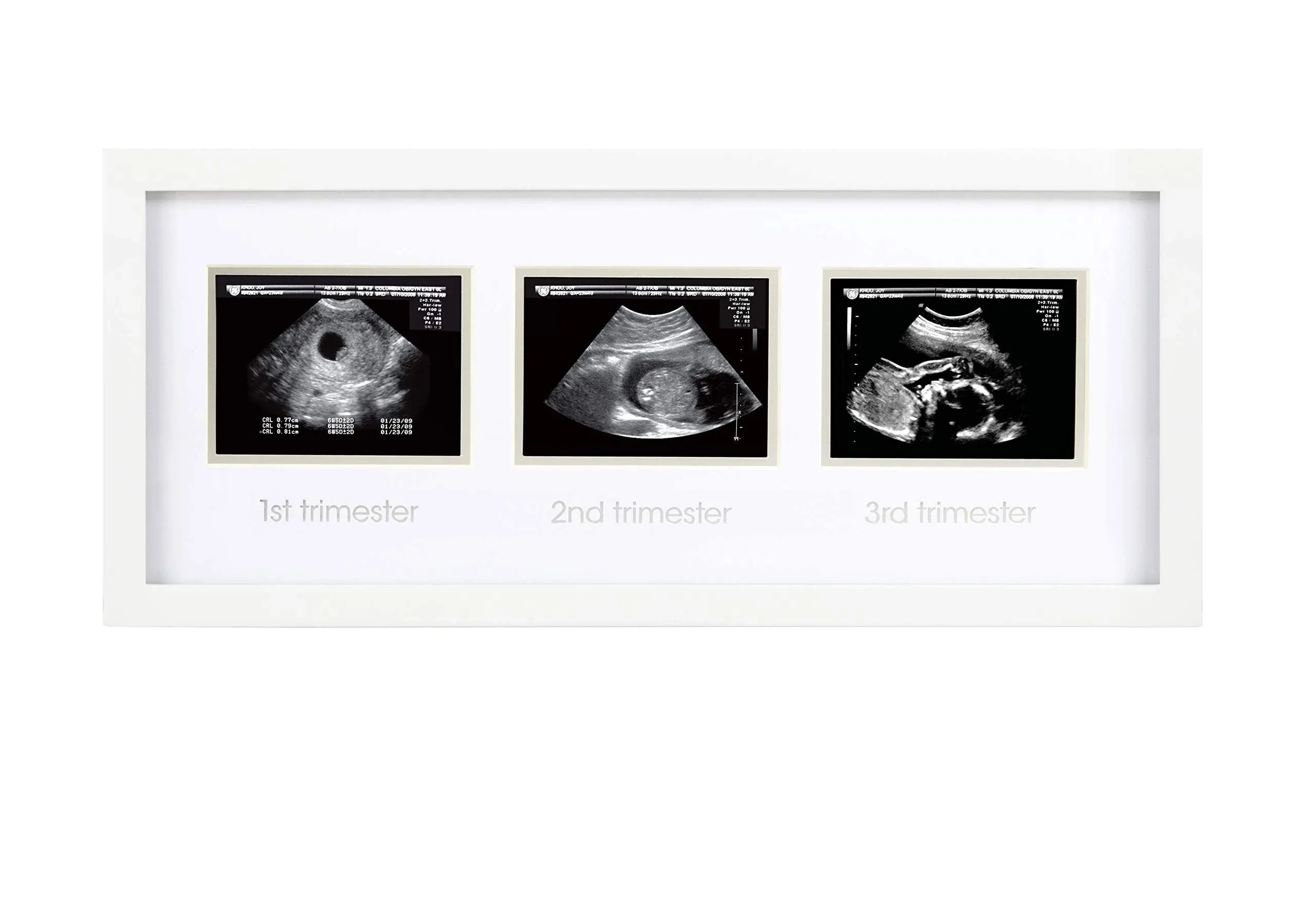 Pearhead - Trimester Sonogram Frame, White