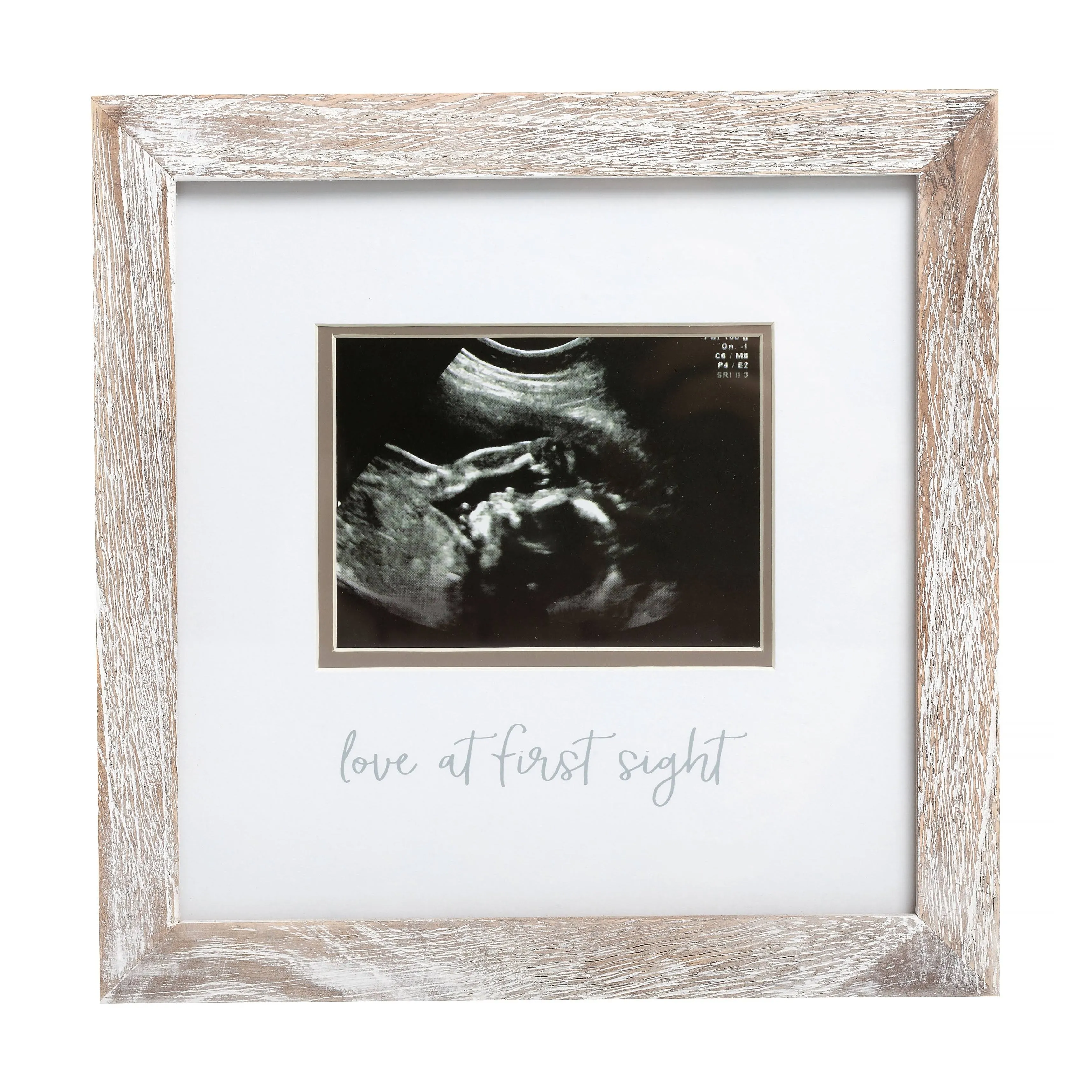 Pearhead Love at First Sight Sonogram Picture Frame