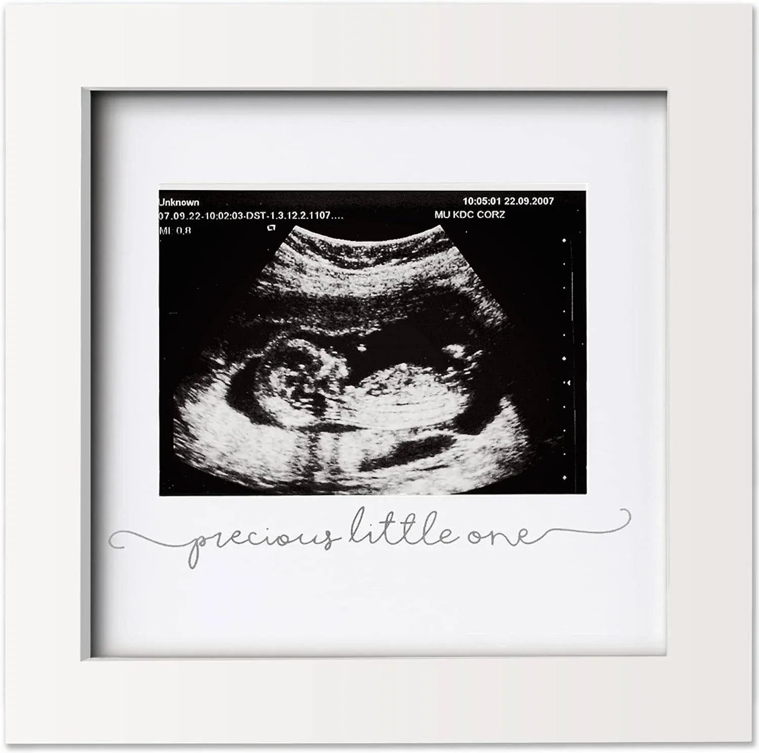 KeaBabies Solo Baby Sonogram Frame