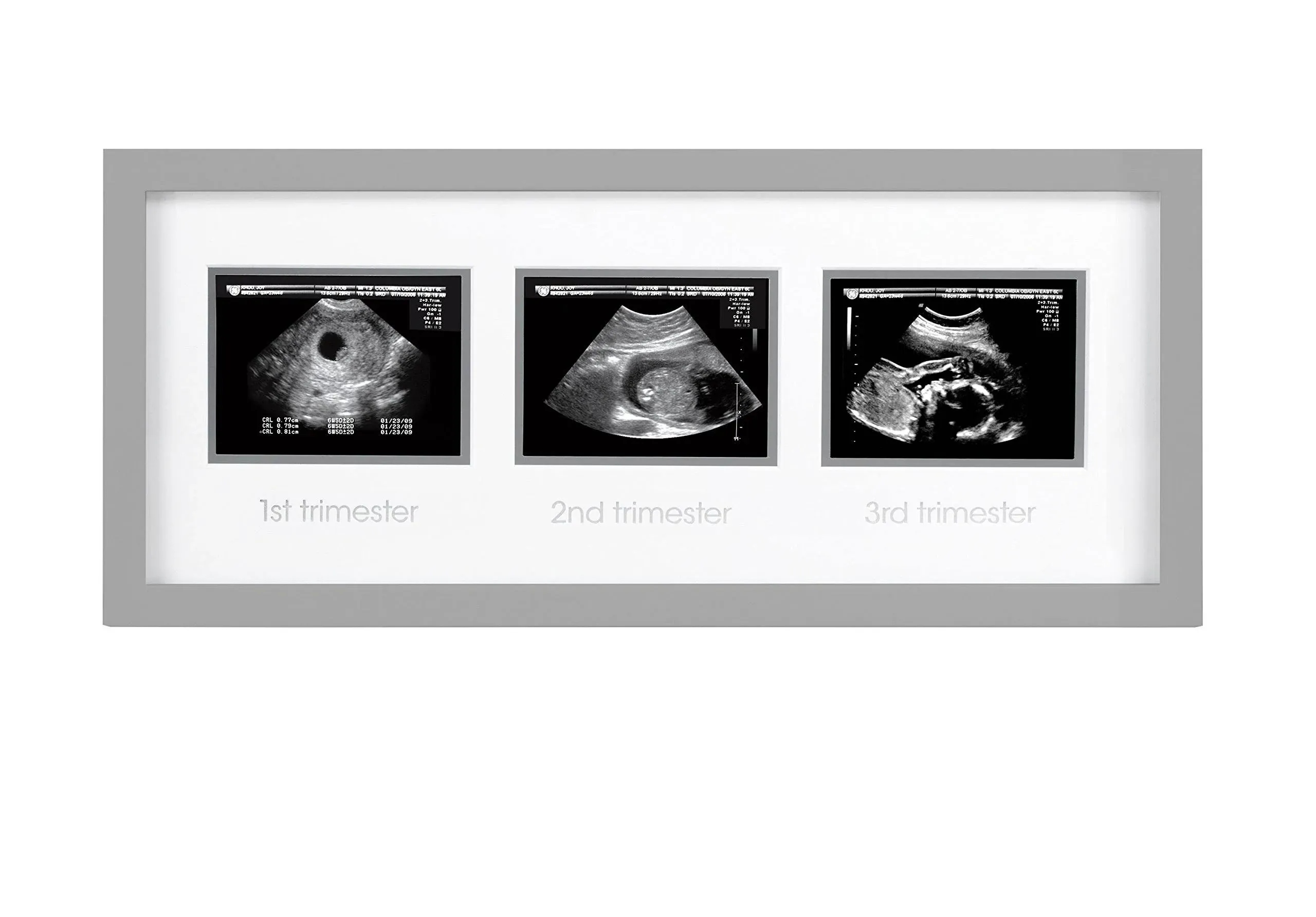 Pearhead Triple Sonogram Picture Frame, Pregnancy Keepsake Photo Frame, Gender-Neutral Baby Nursery Décor, Baby Accessory for New and Expecting Parents, Gray