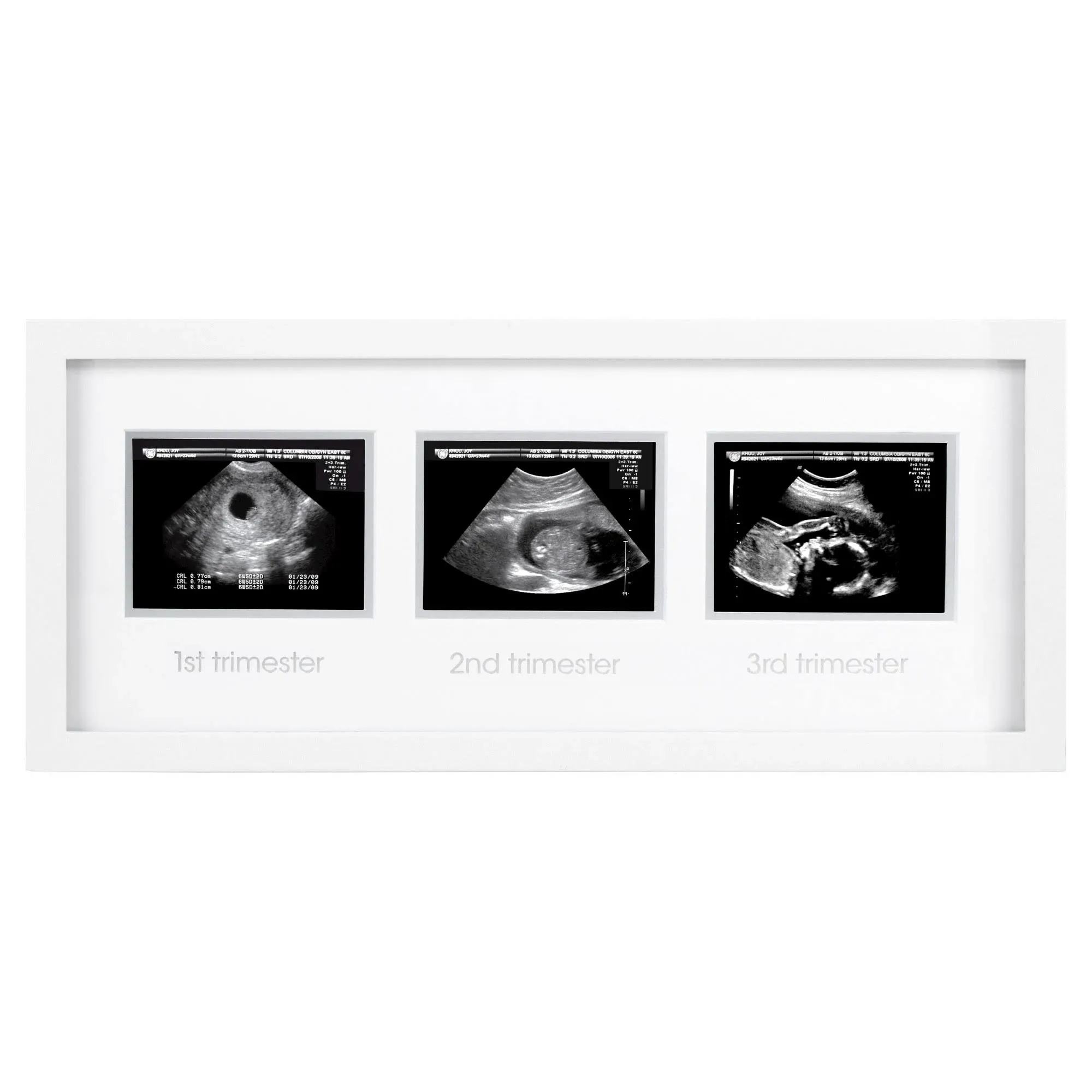 Trimester Sonogram Frame, White